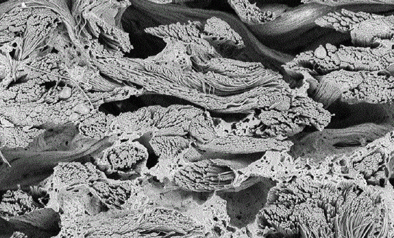 聚氨酯人造革常见针孔缺陷:成因、影响与解决策略